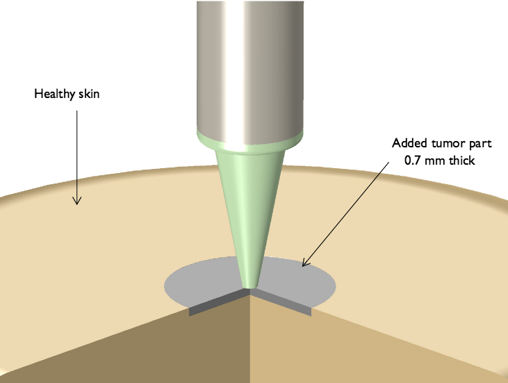 介电探针与皮肤肿瘤的相互作用。