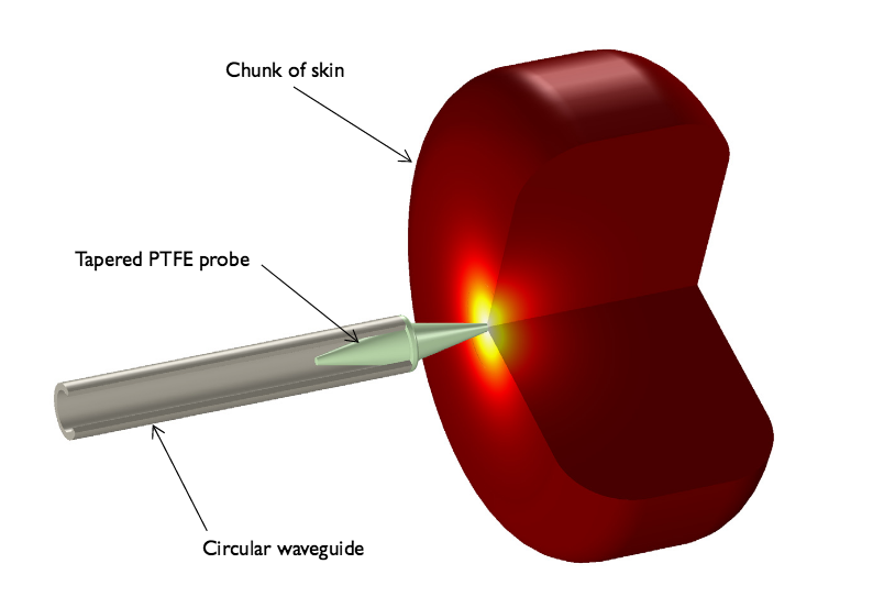 图片显示了用于皮肤癌诊断的锥形电介质探头教程模型。