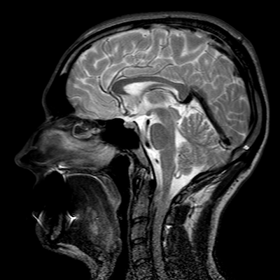 一个 MRI 生成的人体头部