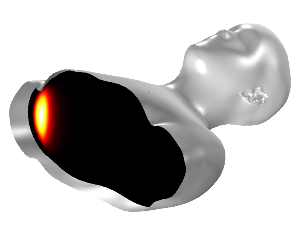 COMSOL Multiphysics的头部和躯干模拟188金宝搏优惠