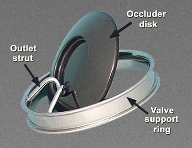 Fatigue, heart valve