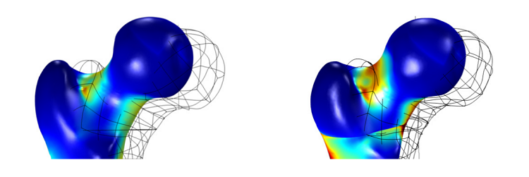 Stress in the femur head in models made with isotropic and anisotropic materials