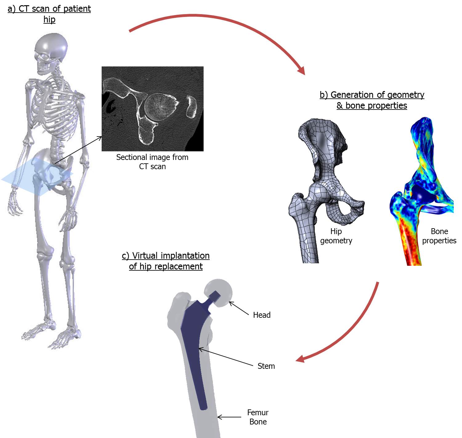 Continuum Blue fretting wear and fatigue analysis of modular implants.