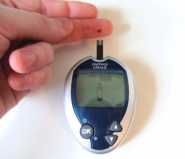 A photograph of a glucose monitoring system.