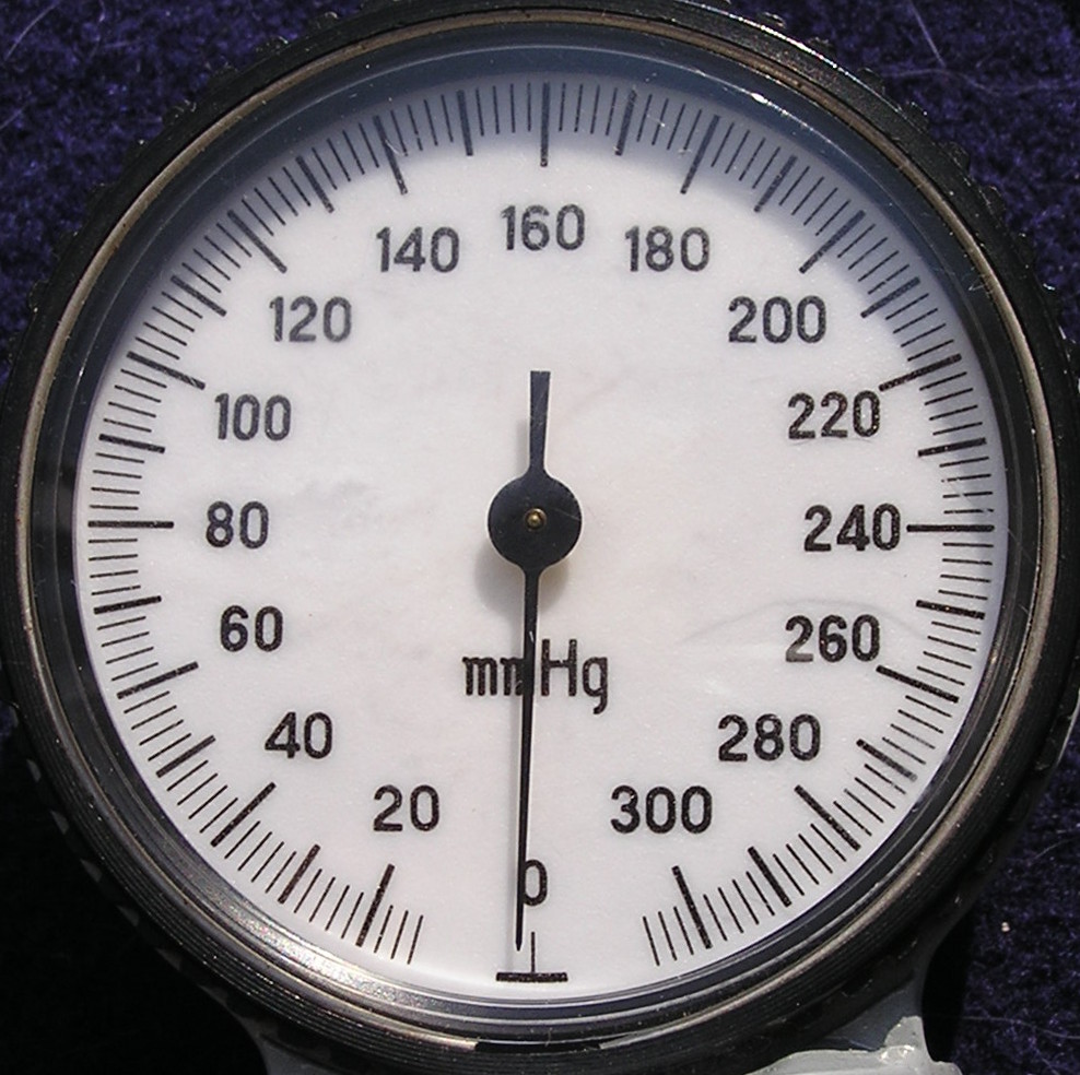 A photograph of a blood pressure measurement device.