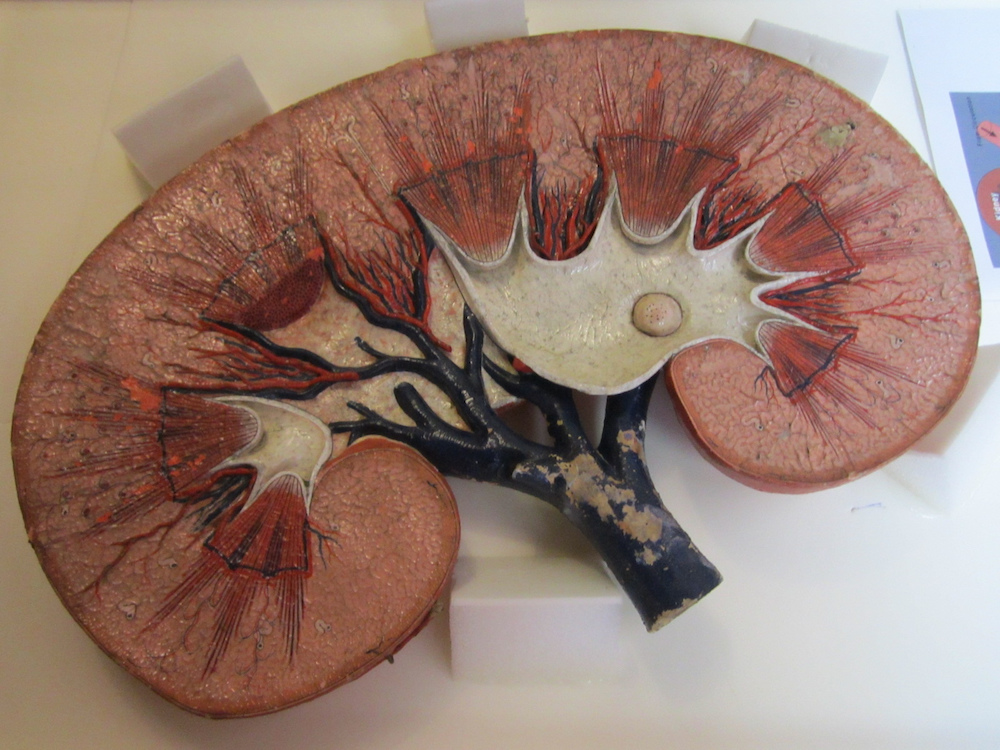 A photograph showing a model of a healthy kidney.