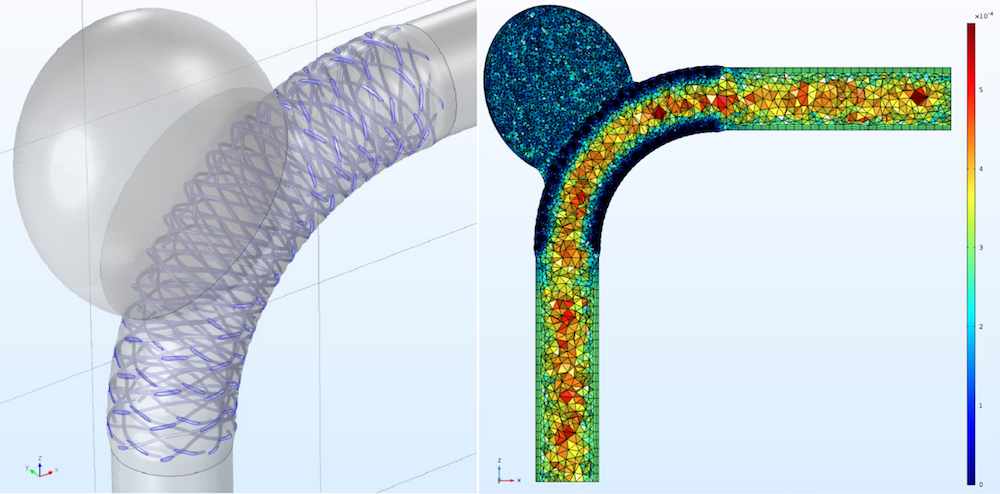 Images showing a model of a blood vessel with an aneurysm and stent and the mesh used for this model.