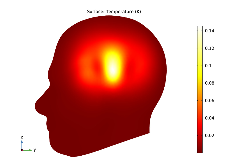 A COMSOL Multiphysics® results plot showing the specific absorption rate in human tissue.