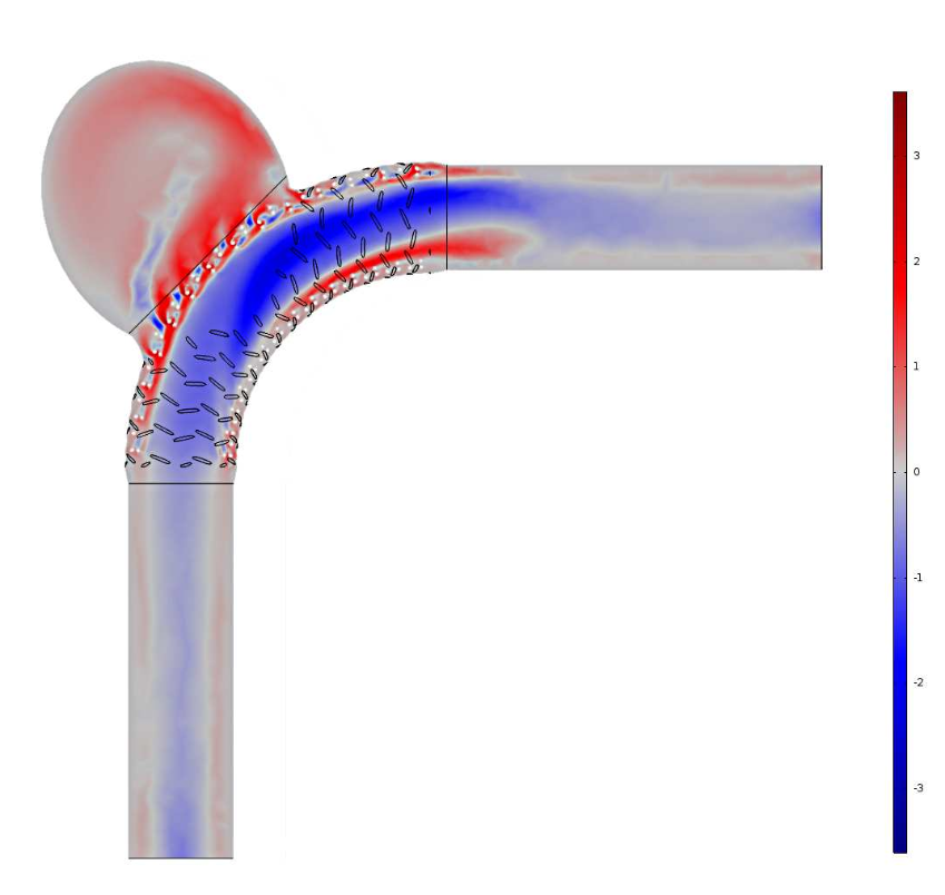 Simulation results showing the difference in velocity profiles for the Newtonian and Carreau-Yasuda models.