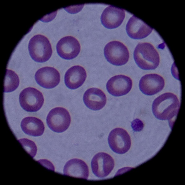 An image of blood cells in the view of a modern-day microscope.