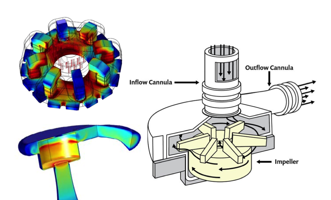 A simulation of an LVAD's magnetically levitated rotor (top left) and pump chamber (bottom left). An illustration of the centrifugal pump of an LVAD (right).