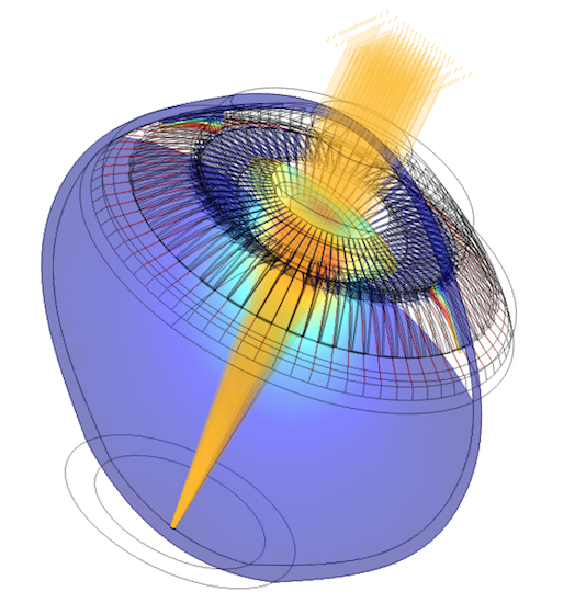 Modèle optomécanique paramétrique d'un globe oculaire humain.