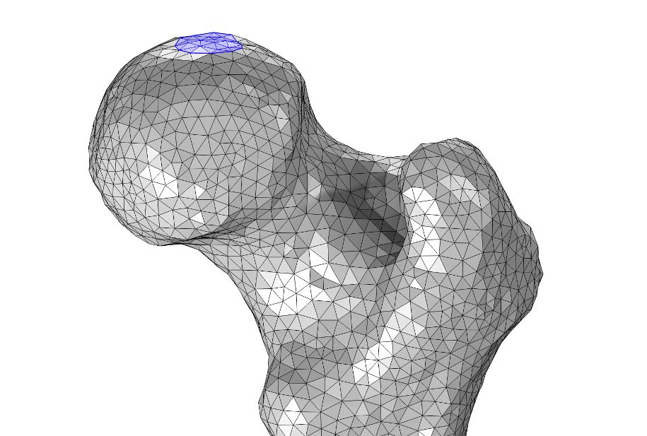 A mesh of a femur, where a section at the top is highlighted with a blue circle.