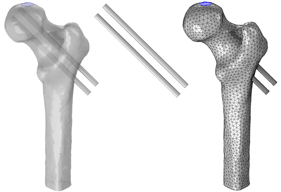 Three side-by-side images of a geometry of a femur reinforced with screws (left), a geometry of the screws after using the Form Union node (middle), and a mesh of the femur reinforced with screws imported into a meshing sequence (right).