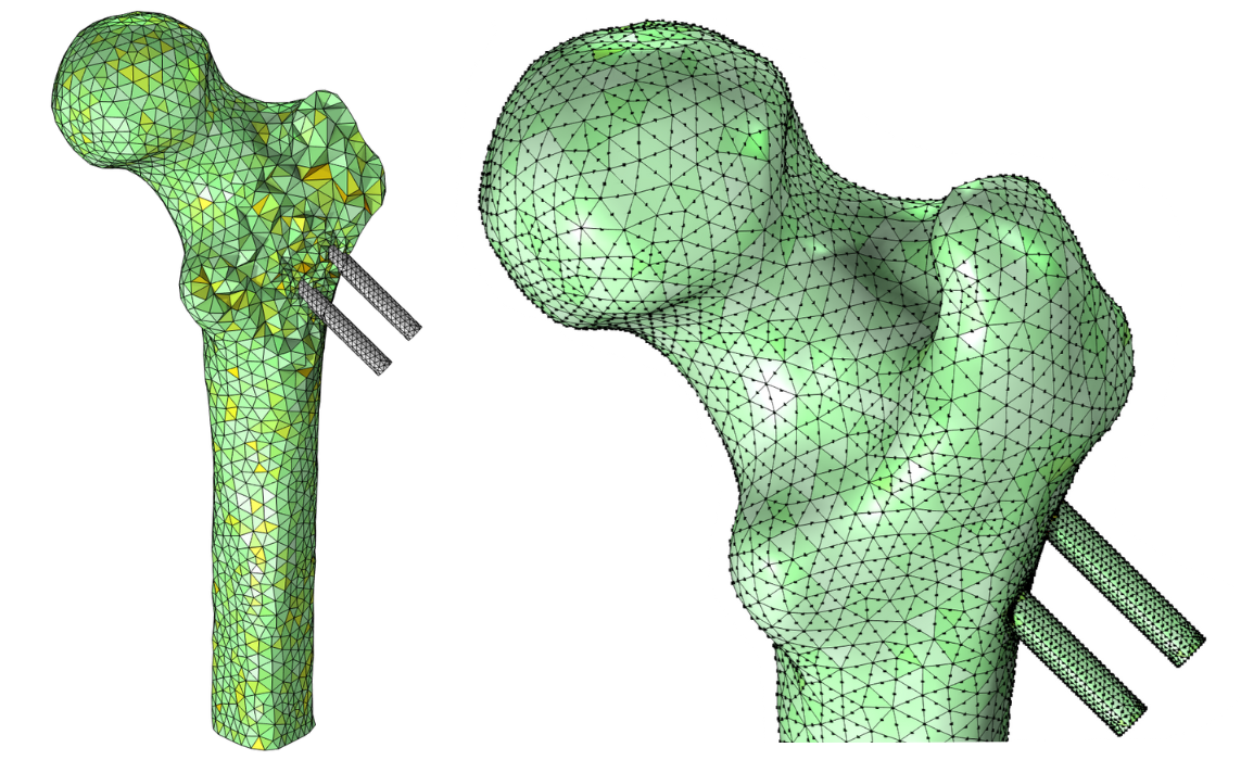A mesh plot of the volume mesh of the femur reinforced by screws is shown on the left, and a close-up of the top of the final mesh of the femur and screws is shown on the right. The final mesh includes second-order node points displayed on the curved boundary of the femur.