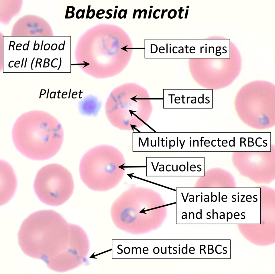 A computer-generated illustration of the parasite Babesia microti, with pink circles with purple spots and labeled text boxes identifying each part.